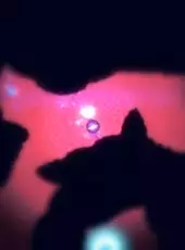 Abyss